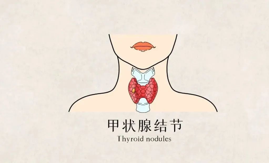 1692953104379349.jpg 640.jpg